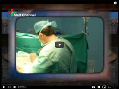 Gynecomastia-male breast reduction