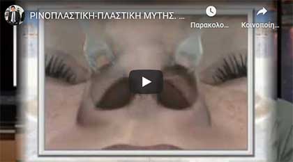 Kapositas Plastic Surgery