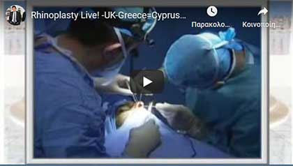Kapositas Plastic Surgery
